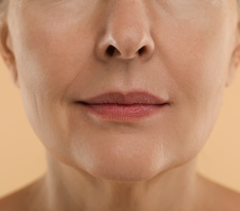 Anti-aging